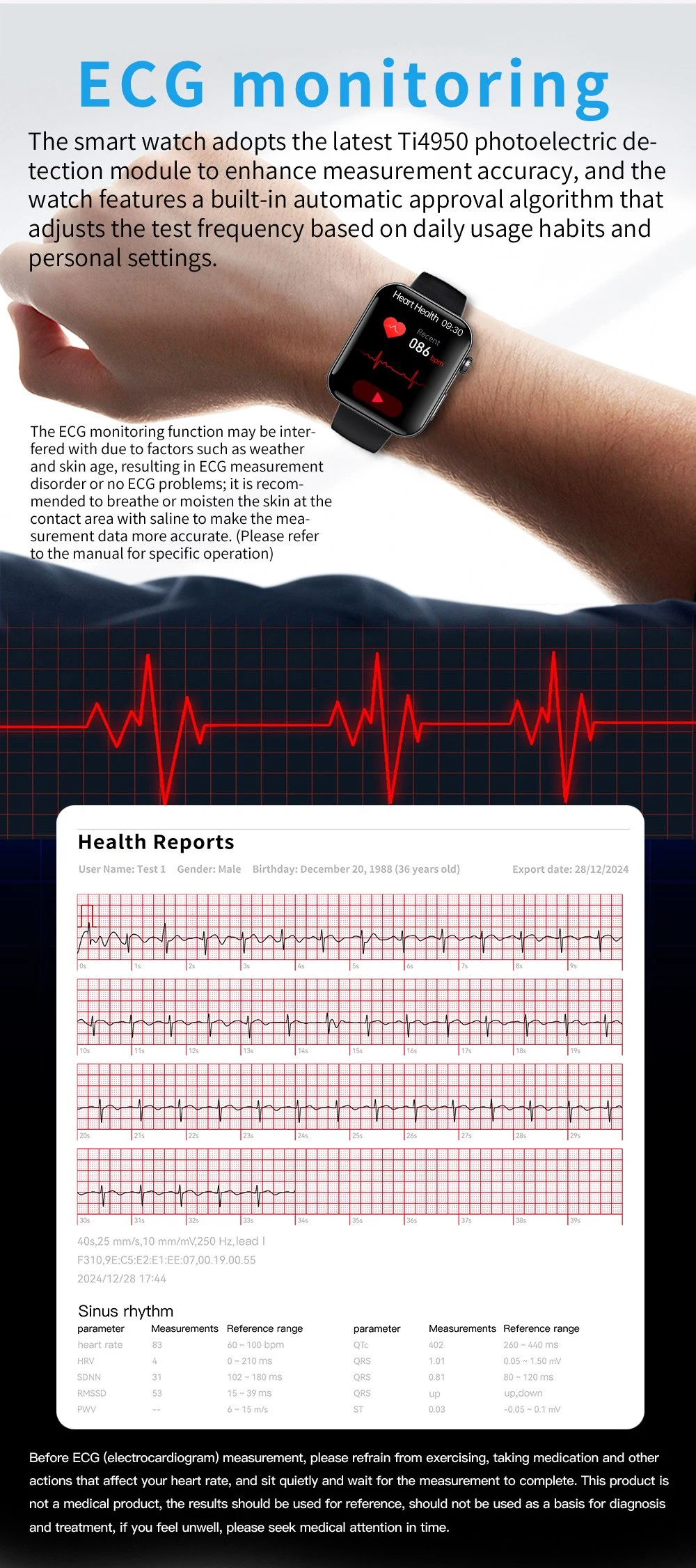 ECG Sport Watch function ECG Sport Watch function